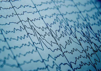 brain activity brainex perfusion